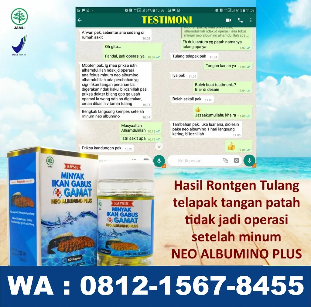 0812-1567-8455 Grosir Neo Albumino Plus Di Maluku Utara