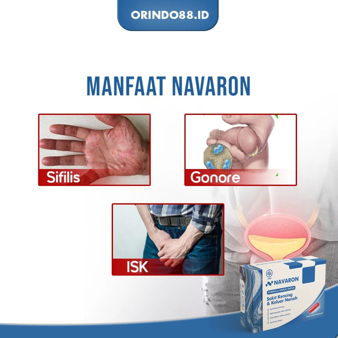 NAVARON Obat Herbal untuk Sipilis dan Gonore Tanpa Efek Samping, Aman untuk Pria dan Wanita