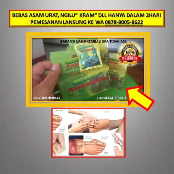 WA: 0878-8005-8622 Obat Asam Urat Tablet Di Kota Palu