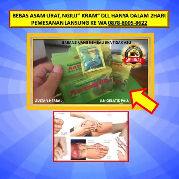 0878-8005-8622 Obat Asam Urat Joss Di Kota Palu