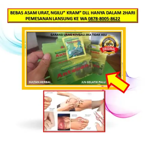 WA: 0878-8005-8622 Obat Asam Urat Untuk Penderita Hipertensi Di Kota Palu