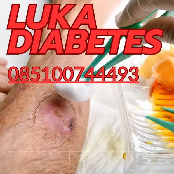 085100744493 Paket Hemat Perawatan Luka Diabetes di Semarang, Harga Bersahabat!