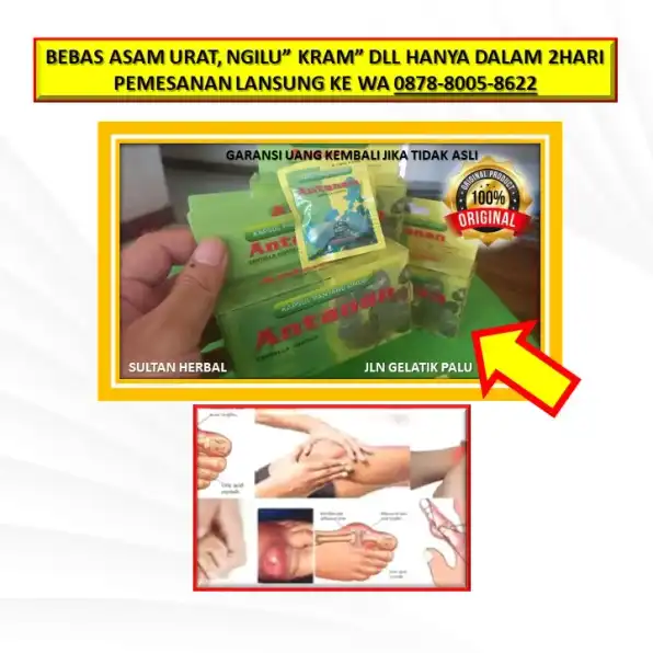 WA: 0878-8005-8622 Obat Asam Urat Bengkak Dan Nyeri Di Kota Palu