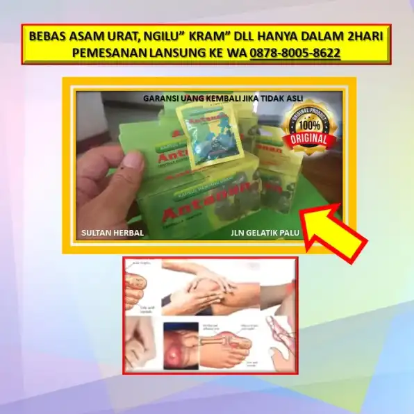 0878-8005-8622 Obat Asam Urat Racikan Di Kota Palu