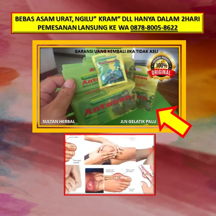 WA: 0878-8005-8622 Obat Kolesterol Alami Yang Bagus Di Kota Palu