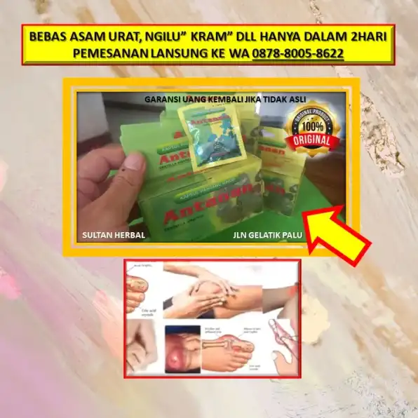 WA: 0878-8005-8622 Obat Asam Urat Apotik Di Kota Palu