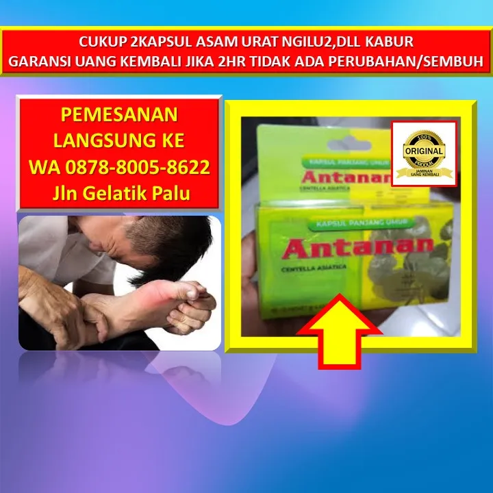 WA: 0878-8005-8622 Obat Asam Urat Tong Mai Dan Di Kota Palu
