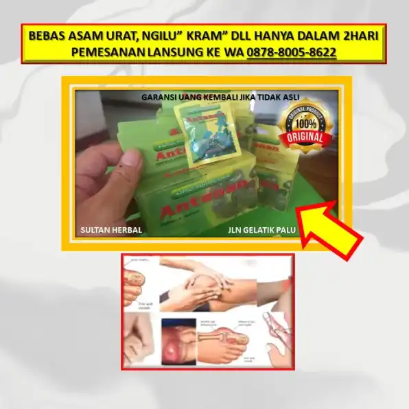 0878-8005-8622 Obat Asam Urat Tangan Bengkak Di Kota Palu