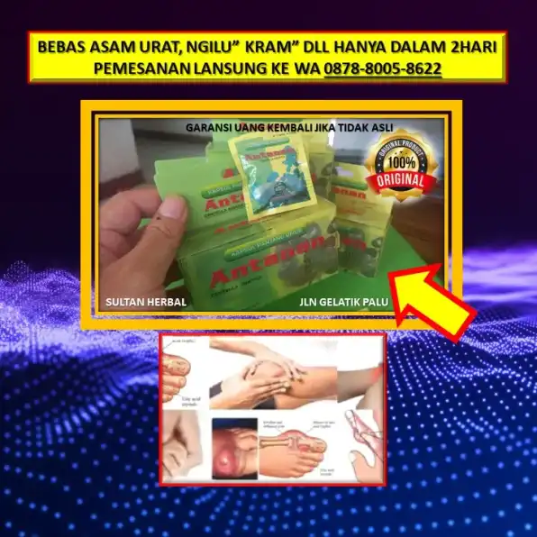 WA: 0878-8005-8622 Obat Asam Urat Menurut Islam Di Kota Palu