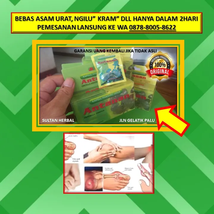 Obat Sakit Kepala Badan Ngilu Di Kota Palu