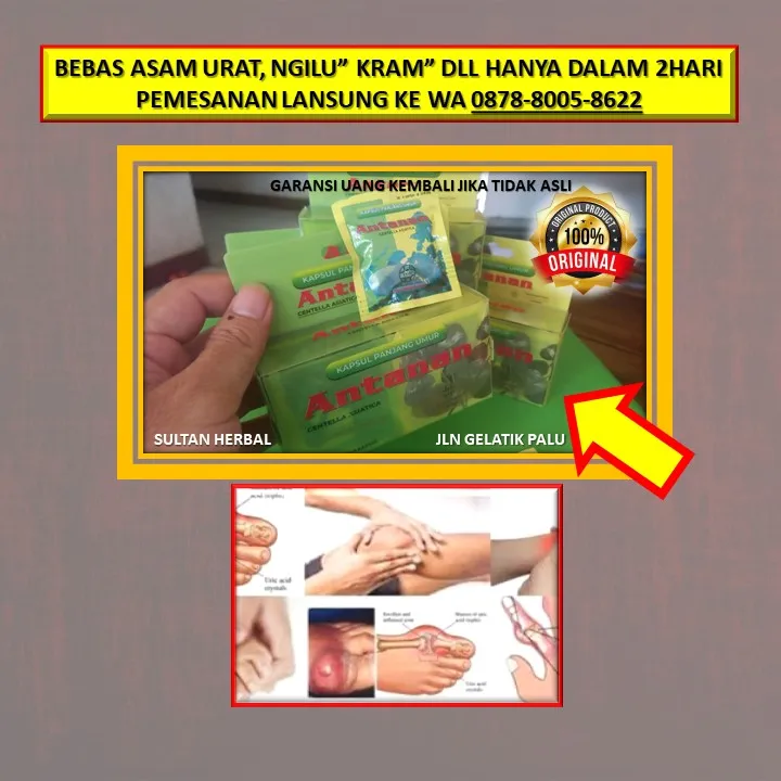 0878-8005-8622 Obat Alami Kolesterol Tinggi Dr Zaidul Akbar Di Kota Palu