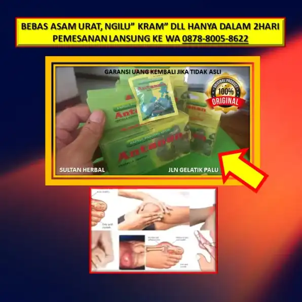 WA: 0878-8005-8622 Obat Asam Urat Paling Bagus Di Kota Palu