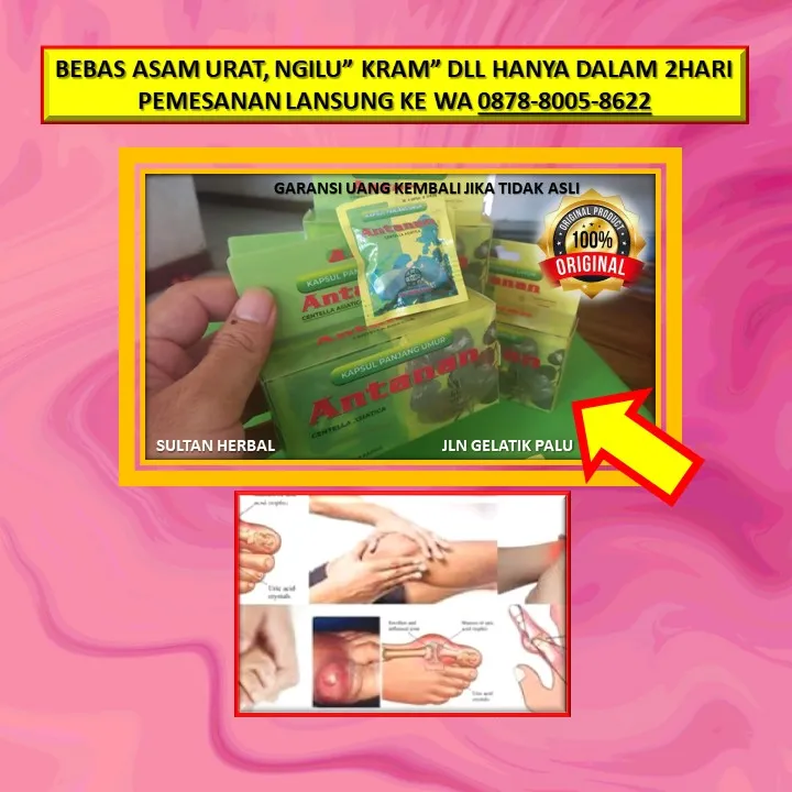 WA: 0878-8005-8622 Obat Kolesterol Adalah Di Kota Palu