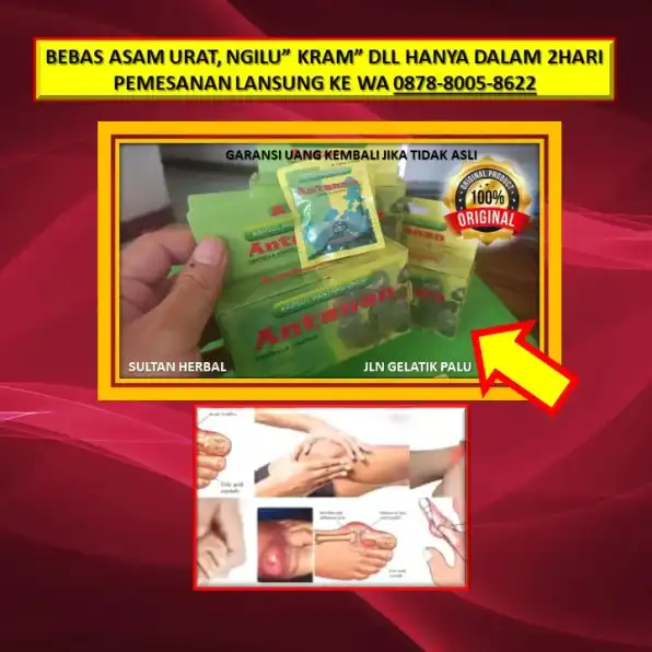 0878-8005-8622 Obat Asam Urat Jsr Di Kota Palu