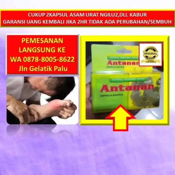 0878-8005-8622 Obat Asam Urat Apa Di Kota Palu