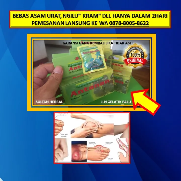 0878-8005-8622 Obat Alami Mengatasi Kolesterol Di Kota Palu