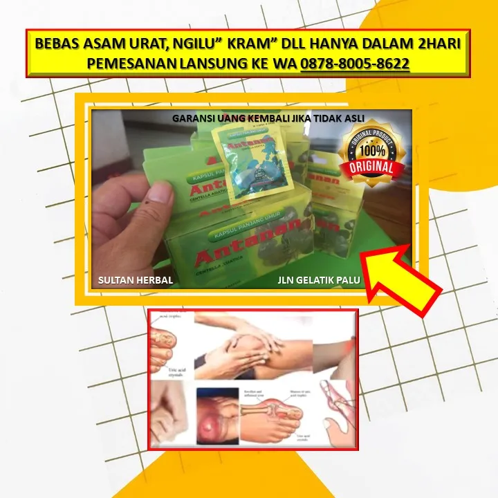 Obat Kolesterol Yang Alami Di Kota Palu