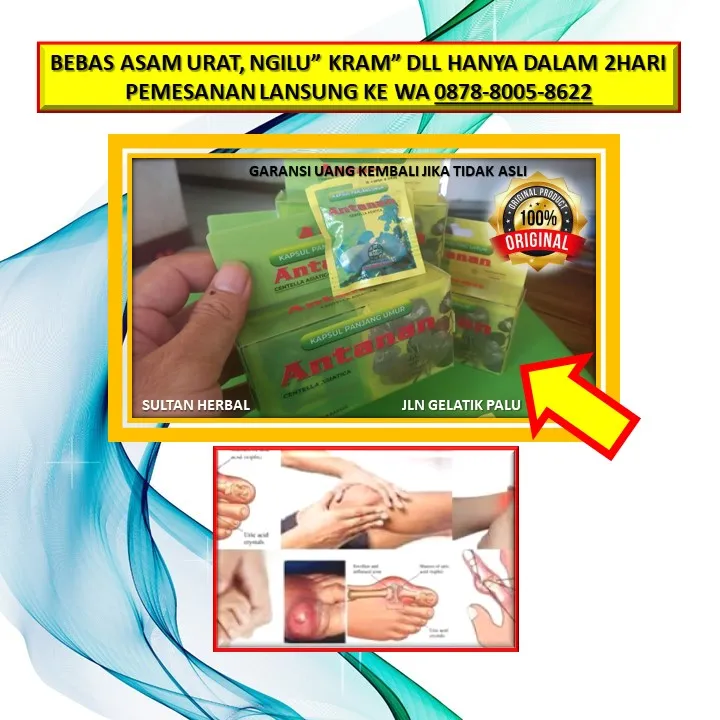 WA: 0878-8005-8622 Obat Asam Urat Yang Paten Di Kota Palu