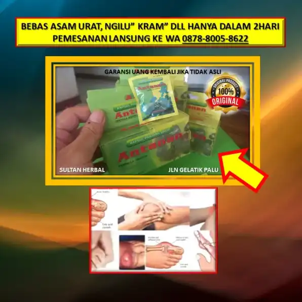 0878-8005-8622 Obat Alami Kolesterol Tinggi Dr Zaidul Akbar Di Kota Palu