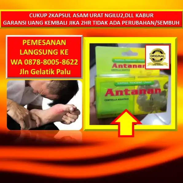 0878-8005-8622 Obat Gejala Kaki Kram Di Kota Palu