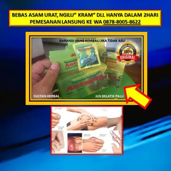 WA: 0878-8005-8622 Obat Asam Urat Di Kaki Di Apotik Di Kota Palu