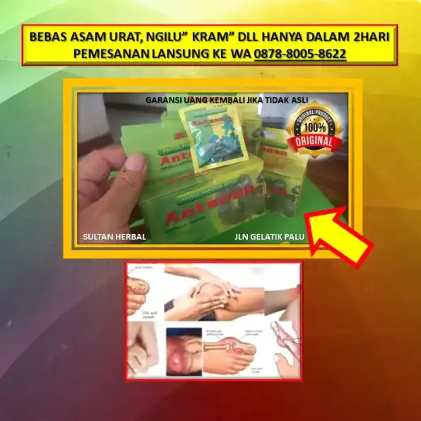 WA: 0878-8005-8622 Obat Asam Urat Namanya Di Kota Palu