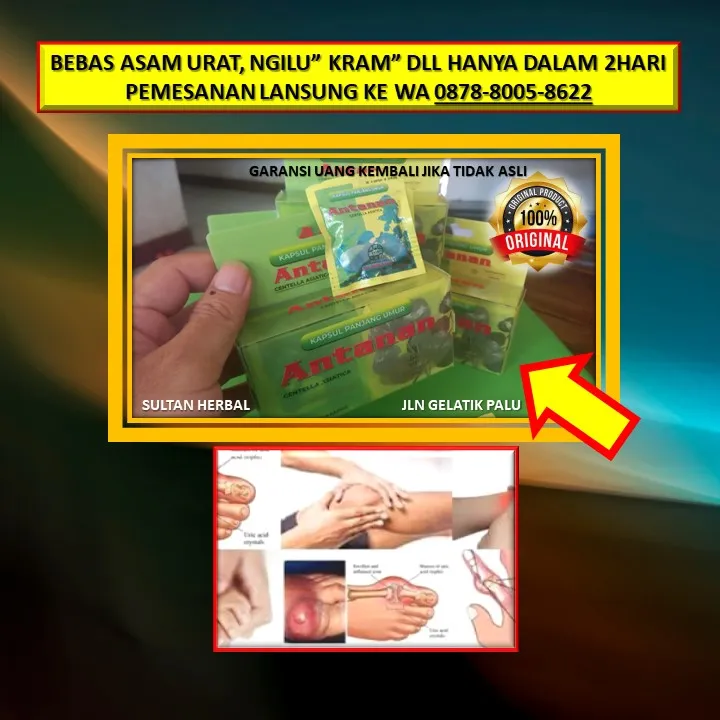 Obat Kolesterol Warna Kuning Di Kota Palu