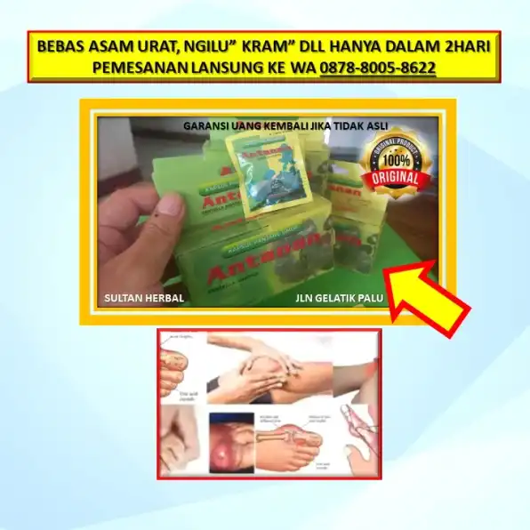 0878-8005-8622 Obat Kram Kaki Pada Ibu Hamil Di Kota Palu