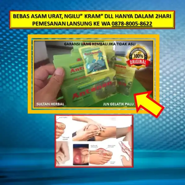 WA: 0878-8005-8622 Obat Asam Urat Herbal Di Apotik Di Kota Palu