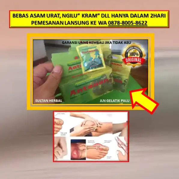 0878-8005-8622 Obat Asam Urat Generik Di Kota Palu