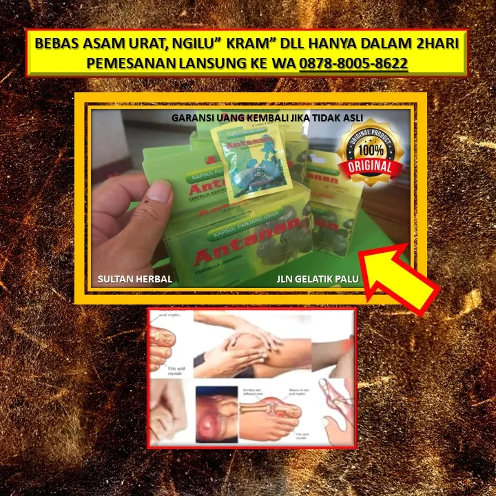 WA: 0878-8005-8622 Obat Kolesterol Alami Daun Salam Di Kota Palu