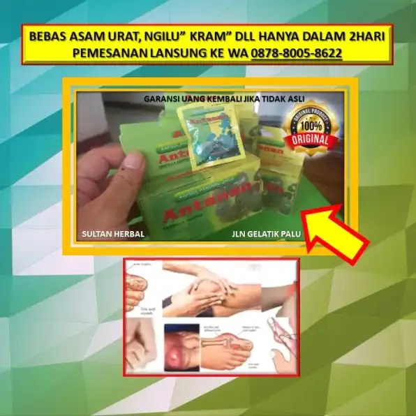 0878-8005-8622 Apa Obat Kolesterol Alami Yang Ampuh Di Kota Palu