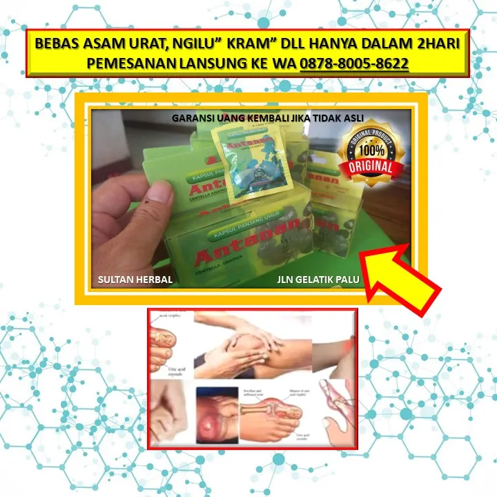 Obat Sakit Kepala Ngilu Di Kota Palu