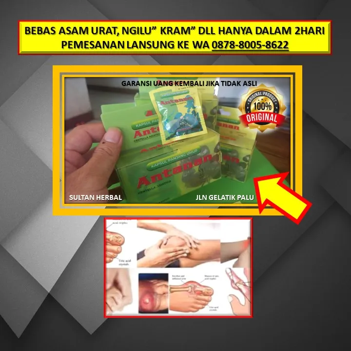 WA: 0878-8005-8622 Obat Kolesterol China Di Kota Palu