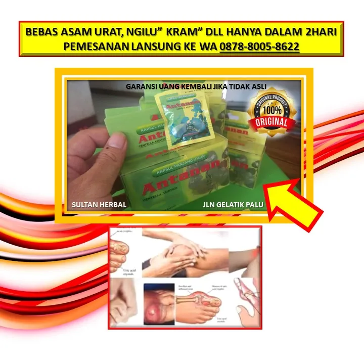 0878-8005-8622 Obat Kolesterol Herbal Yang Bagus Di Kota Palu