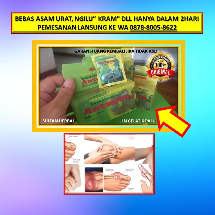 0878-8005-8622 Obat Alami Menurunkan Kolesterol Dengan Cepat Di Kota Palu