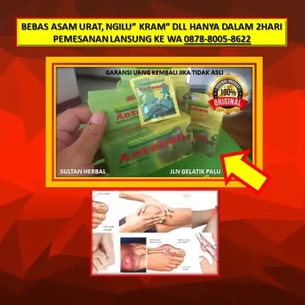 WA: 0878-8005-8622 Obat Asam Urat Kaki Sakit Di Kota Palu