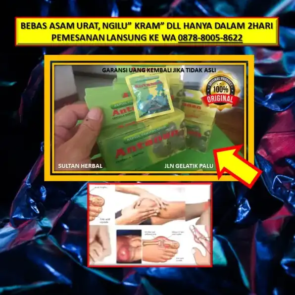 WA: 0878-8005-8622 Obat Asam Urat Obat Warung Di Kota Palu