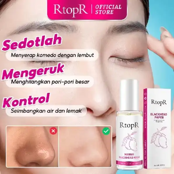 RtopR Mangga Penghilang Komedo Masker Membersihkan Pori-pori Pengobatan Jerawat Serum Peeling Off Ma