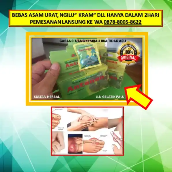 0878-8005-8622 Obat Alami Kolesterol Jahat Di Kota Palu