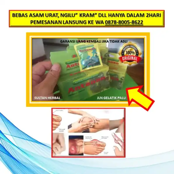 WA: 0878-8005-8622 Obat Asam Urat Bengkak Di Kota Palu