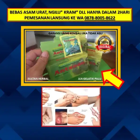 0878-8005-8622 Obat Asam Urat Jempol Kaki Di Kota Palu