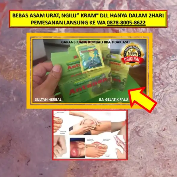 0878-8005-8622 Obat Asam Urat Yang Bengkak Di Kota Palu