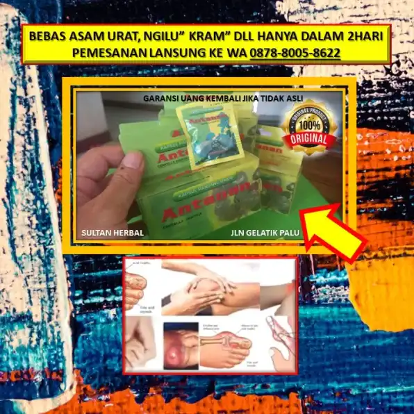 0878-8005-8622 Obat Asam Urat Herbal Kapsul Di Kota Palu