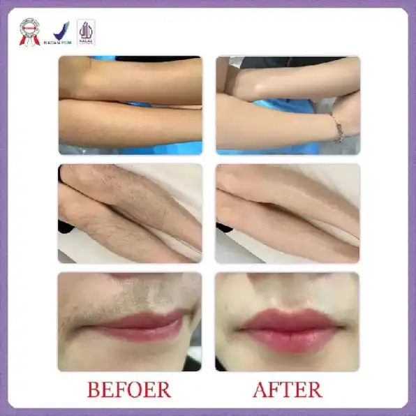 Krim Penghilang Bulu Kemaluan SYB Depilatory Hair Removal Krim Perontok Bulu Miss V Permanen BPOM