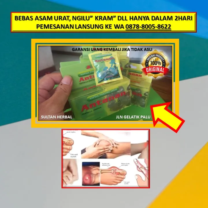 WA: 0878-8005-8622 Obat Efektif Untuk Asam Urat Di Kota Palu