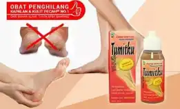 Tumitku Mengatasi Kaki Pecah Pecah