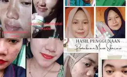 Maxie Skincare Terlarisss