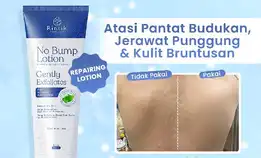 No Bump Lotion / Lotion Tubuh Kulit Bruntusan, Jerawat Punggung & Chicken Skin 100ml