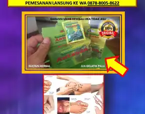 Wa: 0878-8005-8622 Obat Asam Urat Untuk Penderita Tbc Di Kota Palu